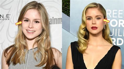 erin moriarty before surgery|Erin Moriarty Plastic Surgery: Analysis and Expert。